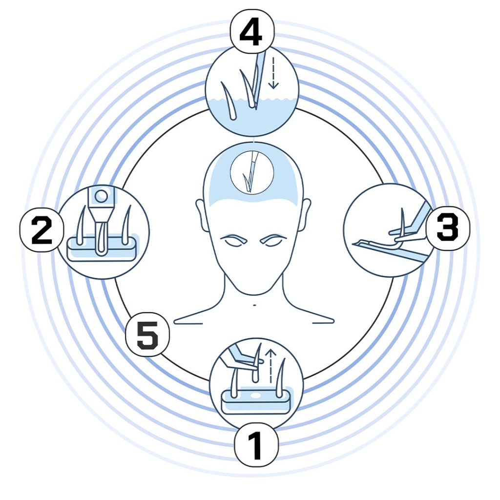 DHI Vita 9 Stages of the DHI VITA Method