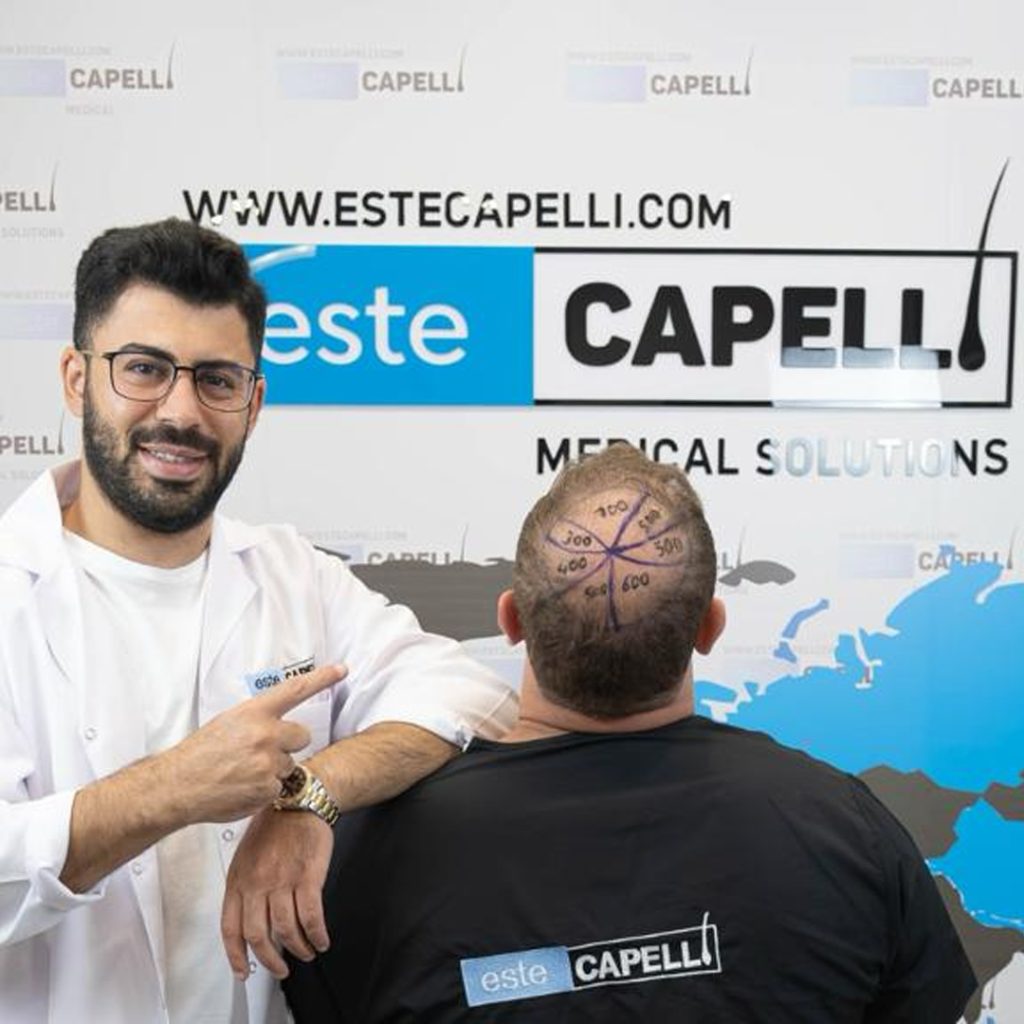 Trasplante Capilar Sapphire FUE 8 Top Sapphire FUE Hair Transplant Surgeons in Miami and istanbul Estecapellis Expertise2