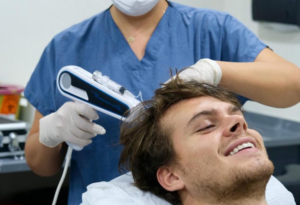 Mesoterapia Capilar 1 What is Hair Mesotherapy3