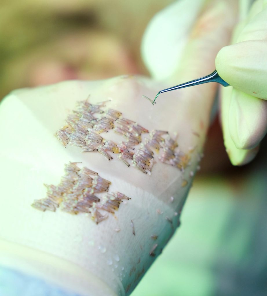 FUE Vita 3 Why Do Grafts Weaken After the Extraction 1