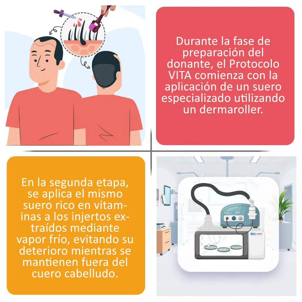 FUE Vita 5 How does FUE VITA Workispanyolca 1024x1024 1