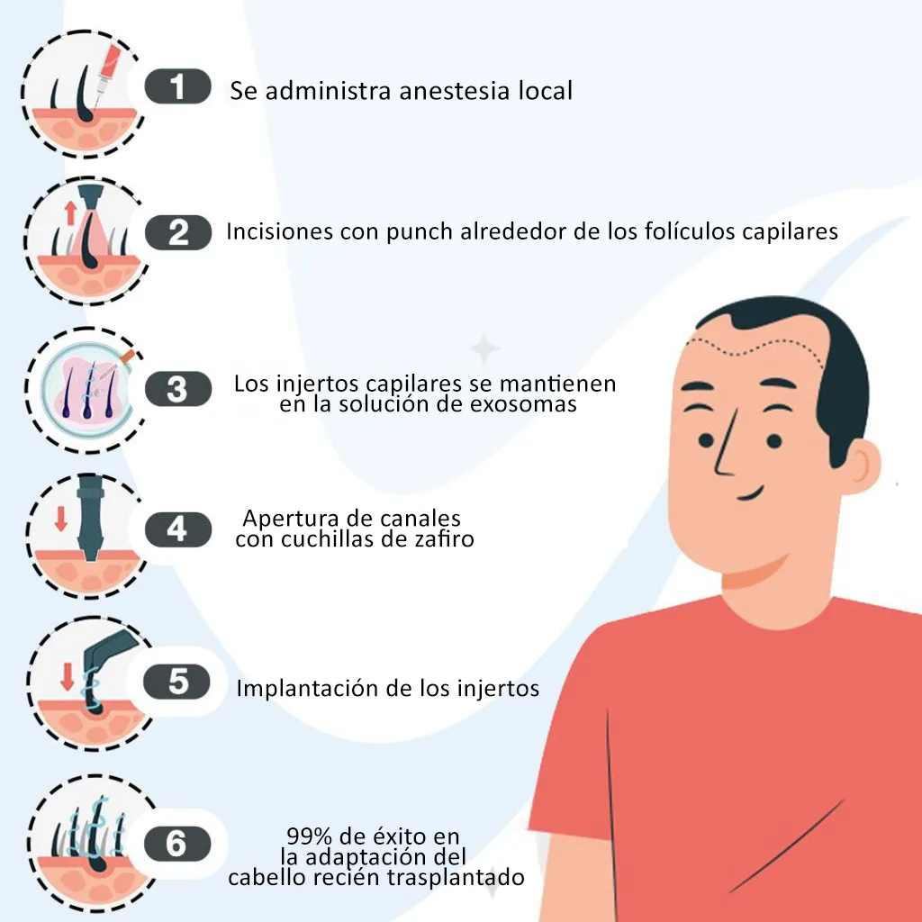 Trasplante Capilar Exosomas FUE 1 What is an Exosome FUE Hair Transplant The Latest in Hair Restoration Technolog