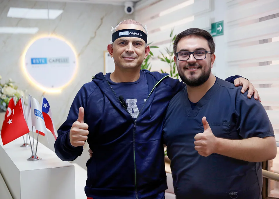 Precio implante de barba Chile 2026 - resultado natural con técnica FUE Vita en Estecapelli
