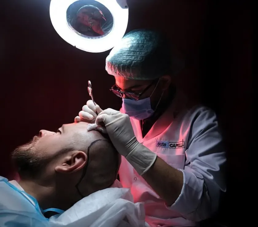 ¿Cuál es la edad ideal para el trasplante de cabello?