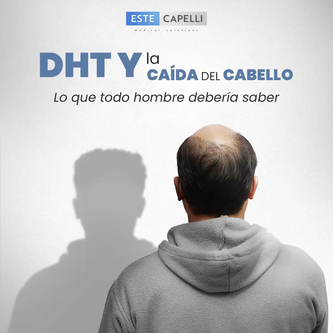 Diagrama de DHT y caída del cabello