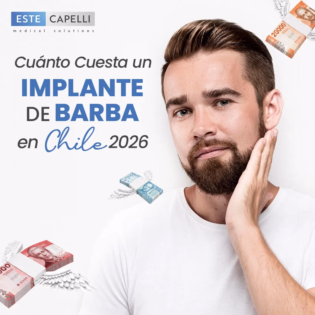 cuánto cuesta implante de barba chile